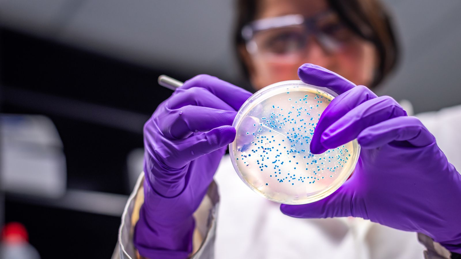 E.coli infections rise by 26% – as source of outbreaks and most vulnerable age groups revealed | UK News